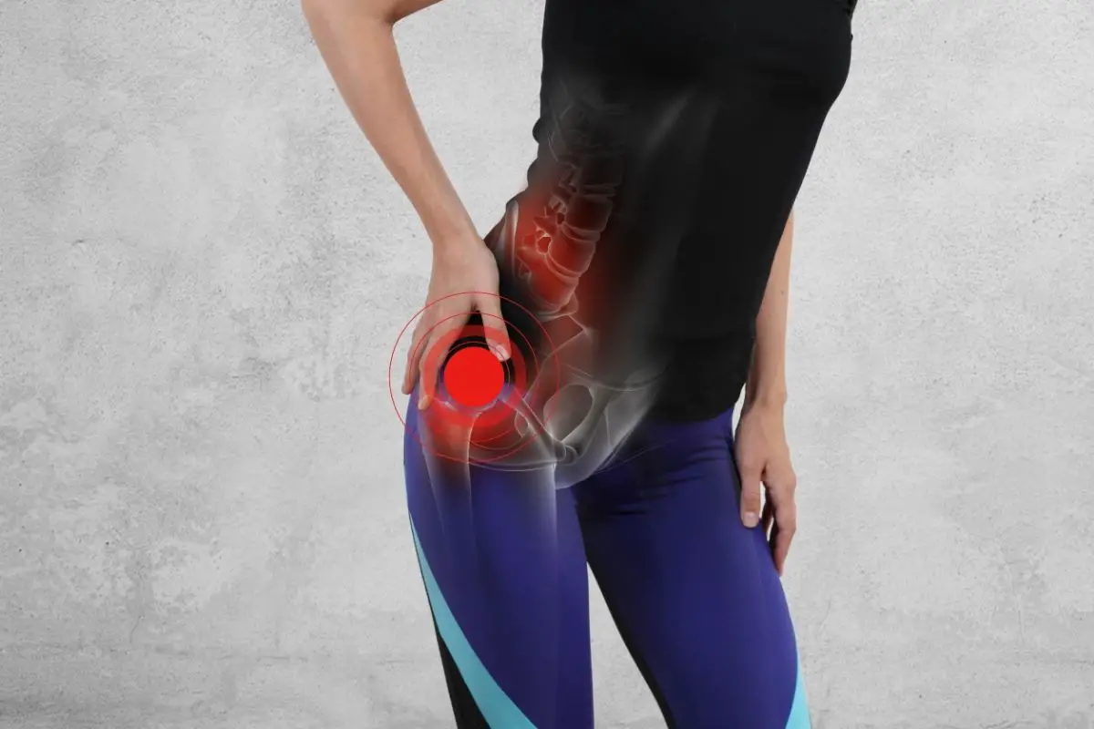 Ultimate Guide to Gluteus Medius Injuries: Tear and Strain